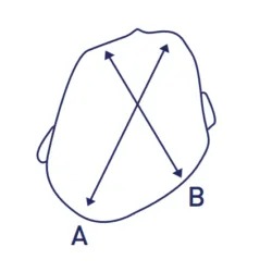 plagio_cranio plagio_cranio